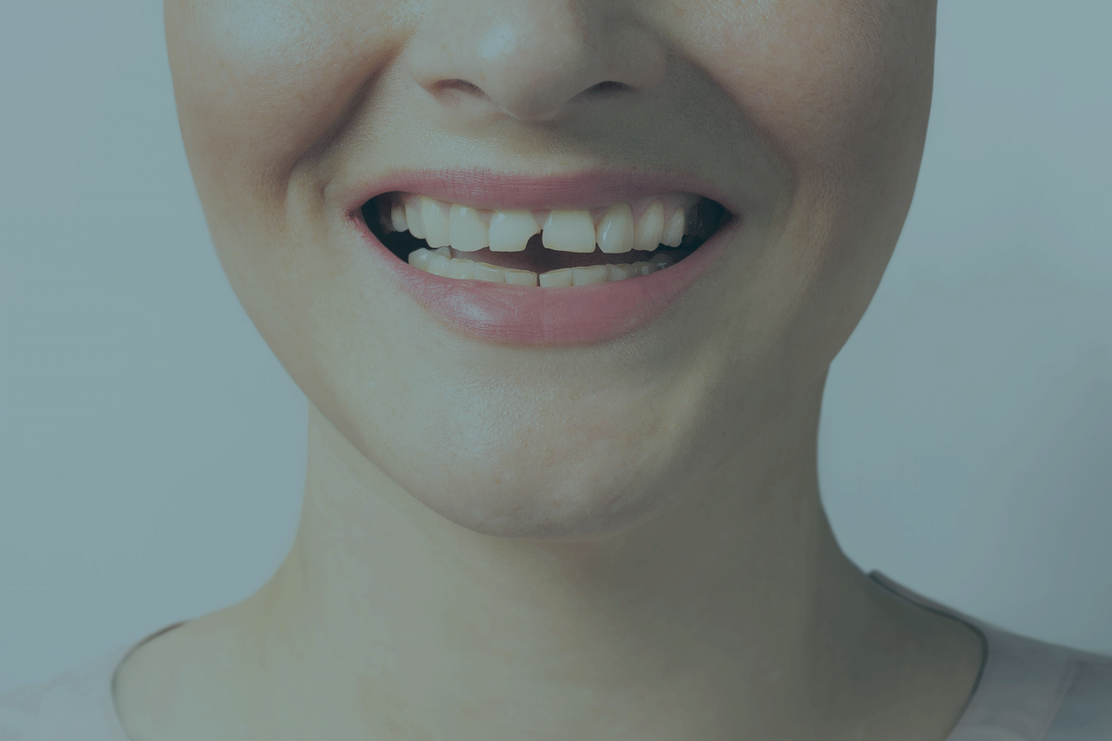 Emergency Dentistry