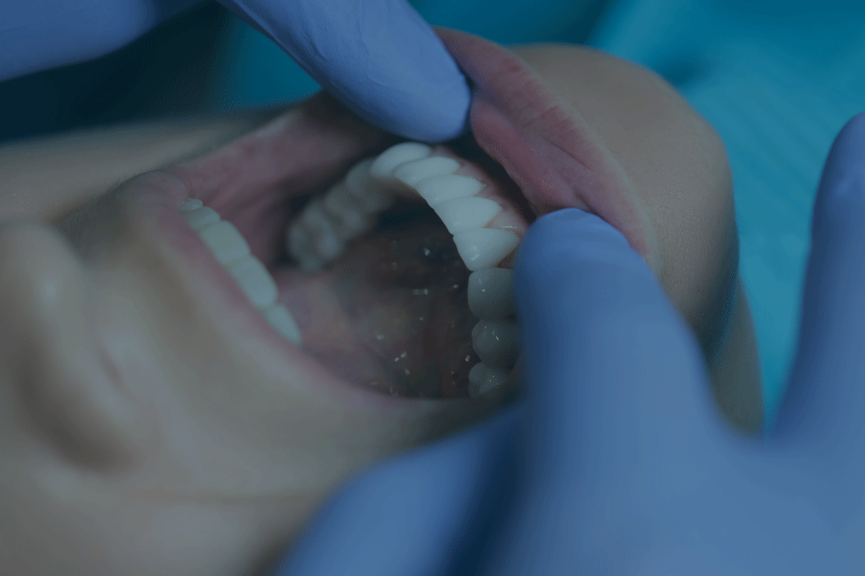 Dental Exams