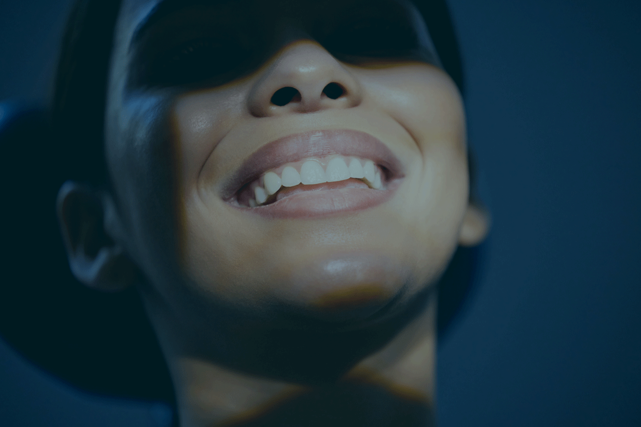 Teeth Whitening